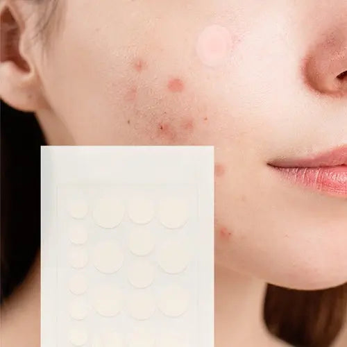 Hydrocolloid Pimple Patch, 120-Count, Multi Size Acne Solution 5 Pack Cosmetolux