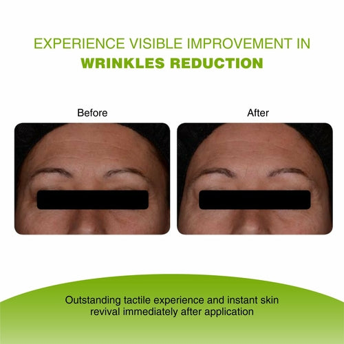 Cosmetolux Vijuve Vitamin C Face Serum with double hyaluronic acid and collagen, showing the serum bottle and applicator.
