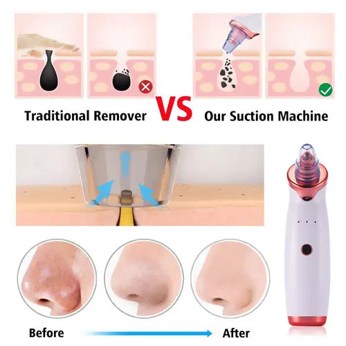 Cosmetolux electric blackhead remover device for acne treatment, featuring a sleek black design and multiple suction heads.
